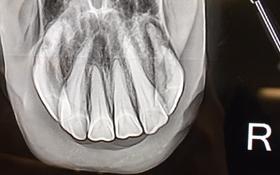 Intraoral radiographs of horse's incisors