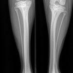 X-ray of a horse's leg