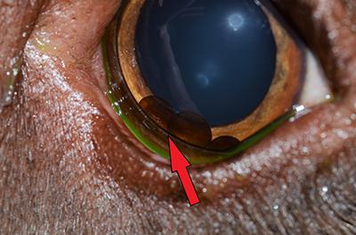 A close up of a Labrador's eye with an arrow pointing to a dark mass at the bottom of it. 