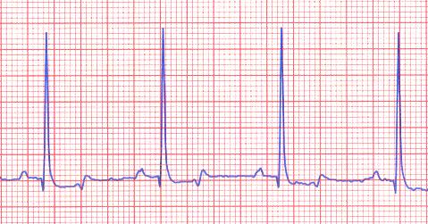 Electrocardiogram from a normal dog