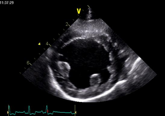 an echocardiogram (echo) of a dog heart