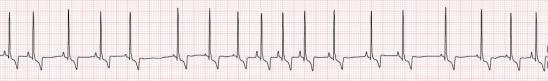 Electrocardiogram from a normal dog.