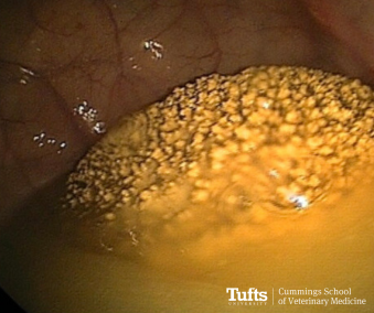 Cystoscopy of the patient in this case, with a large urolith seen partially immersed in a pool of urine.""
