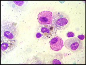 Staining purple granules of mast cells associated with respiratory allergies