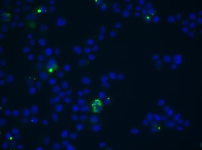 blue cell nucleus