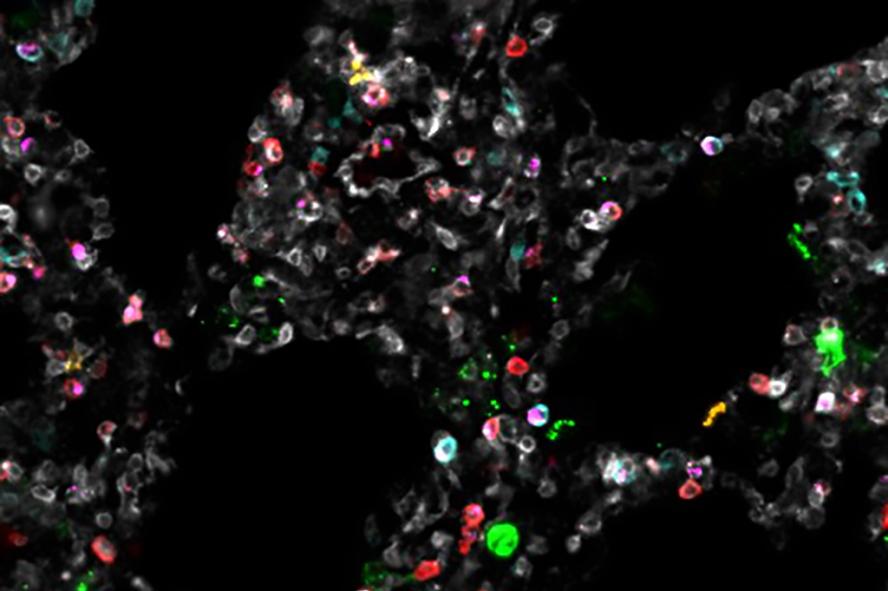 Image of multiple virus cells