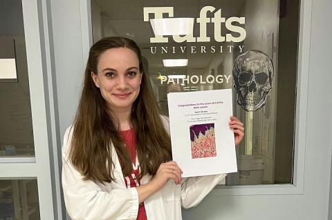 Smiling women with long brown hair wearing a white coat holding up a piece of paper with an image of the maxilla skin from a dog stained with Movat's Pentachrome technique. Glass door behind her reads Tufts University Pathology.