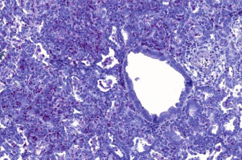 A photo with purple, white and red proteins.